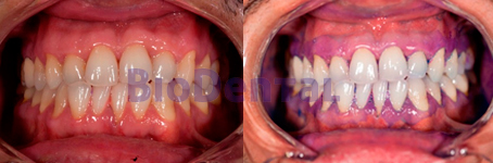 Periodoncia y cirugía periodontal