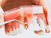 Clínica Biodental Blanes Institut Odontológic