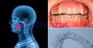 Dolor orofacial