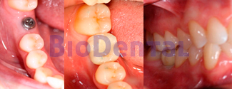 Clínica Biodental Blanes Institut Odontológic