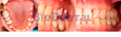 Clínica Biodental Blanes Institut Odontológic