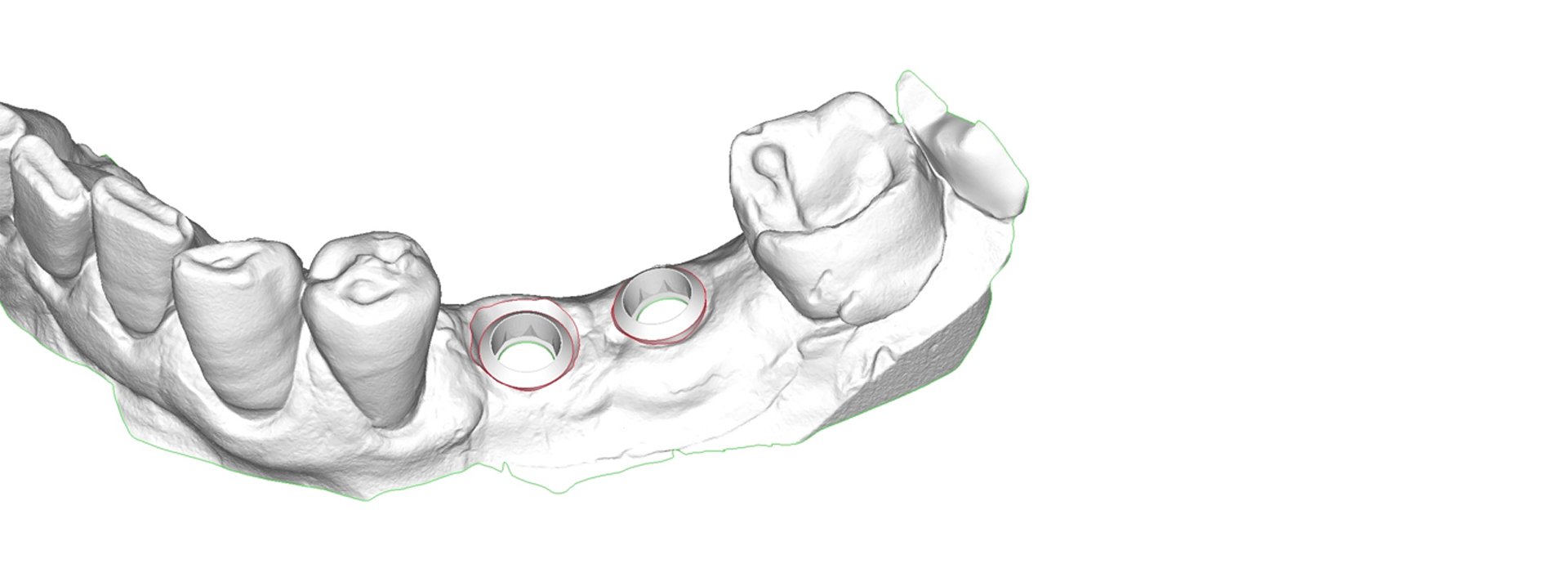 Clínica Biodental Blanes Institut Odontológic